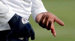 Andre Johnson dislocates finger